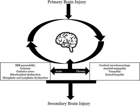 Neuroinflammation and TBI